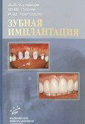 Зубная имплантация (А. Ф. Лосев, А. Ф. Антипин, и ещё 7 авторов, 2006)